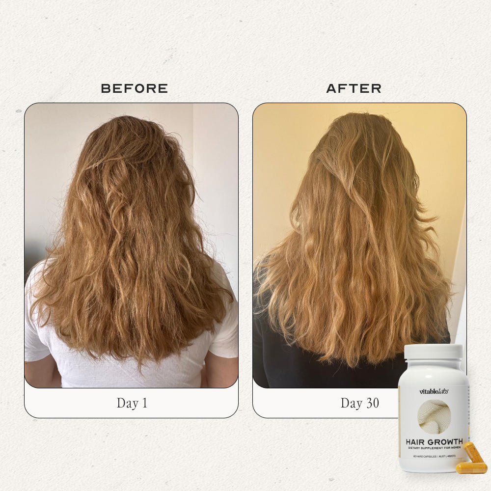 Hair Growth Capsules for Women