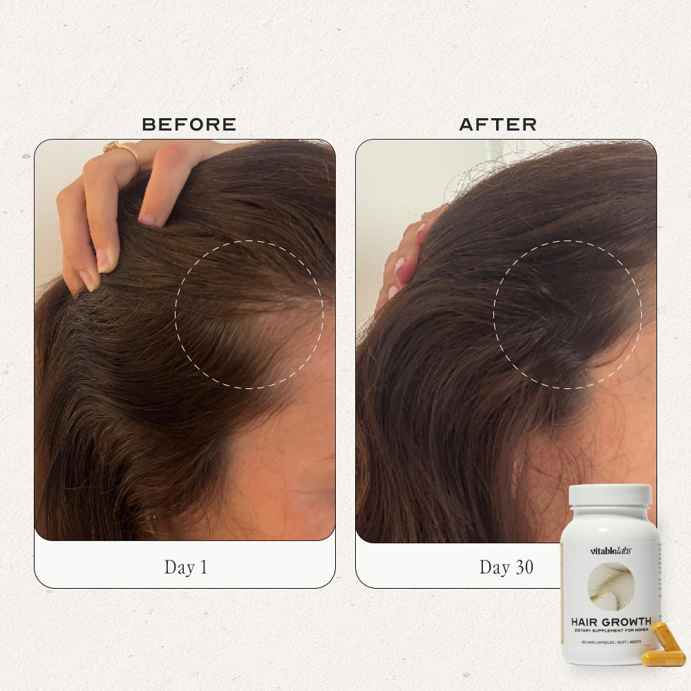 Hair Growth Capsules for Women