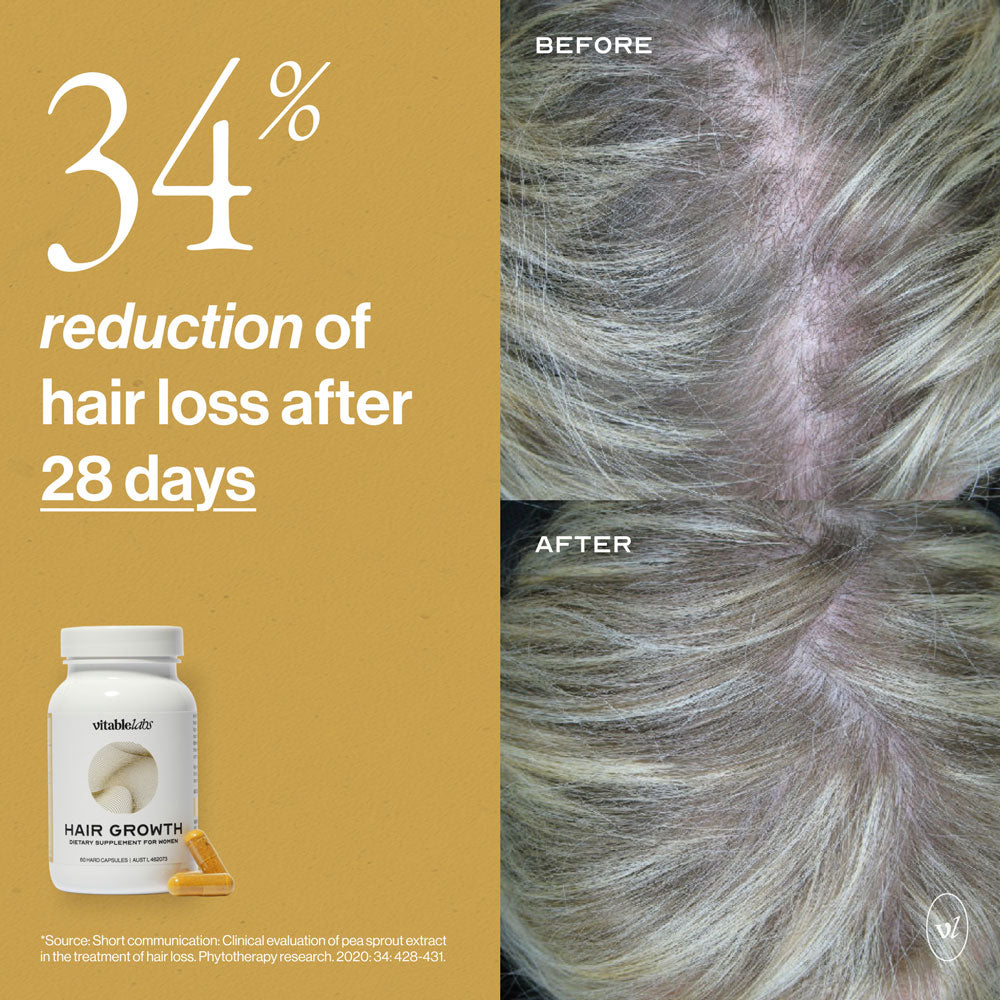 Hair Growth Capsules for Women